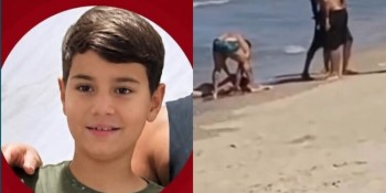 Menino de 11 anos tem perna amputada após ataque de tubarão em Pernambuco